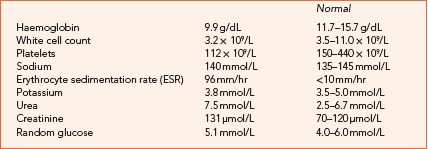 Can You Diagnose This 62-year-old Woman?
